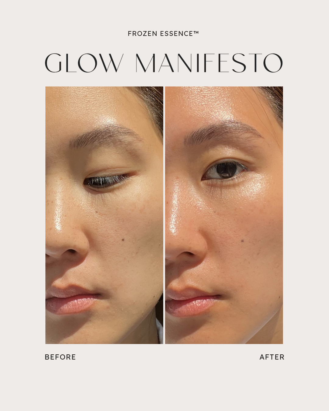 Before and after — Glow Manifesto · Radiance & tone