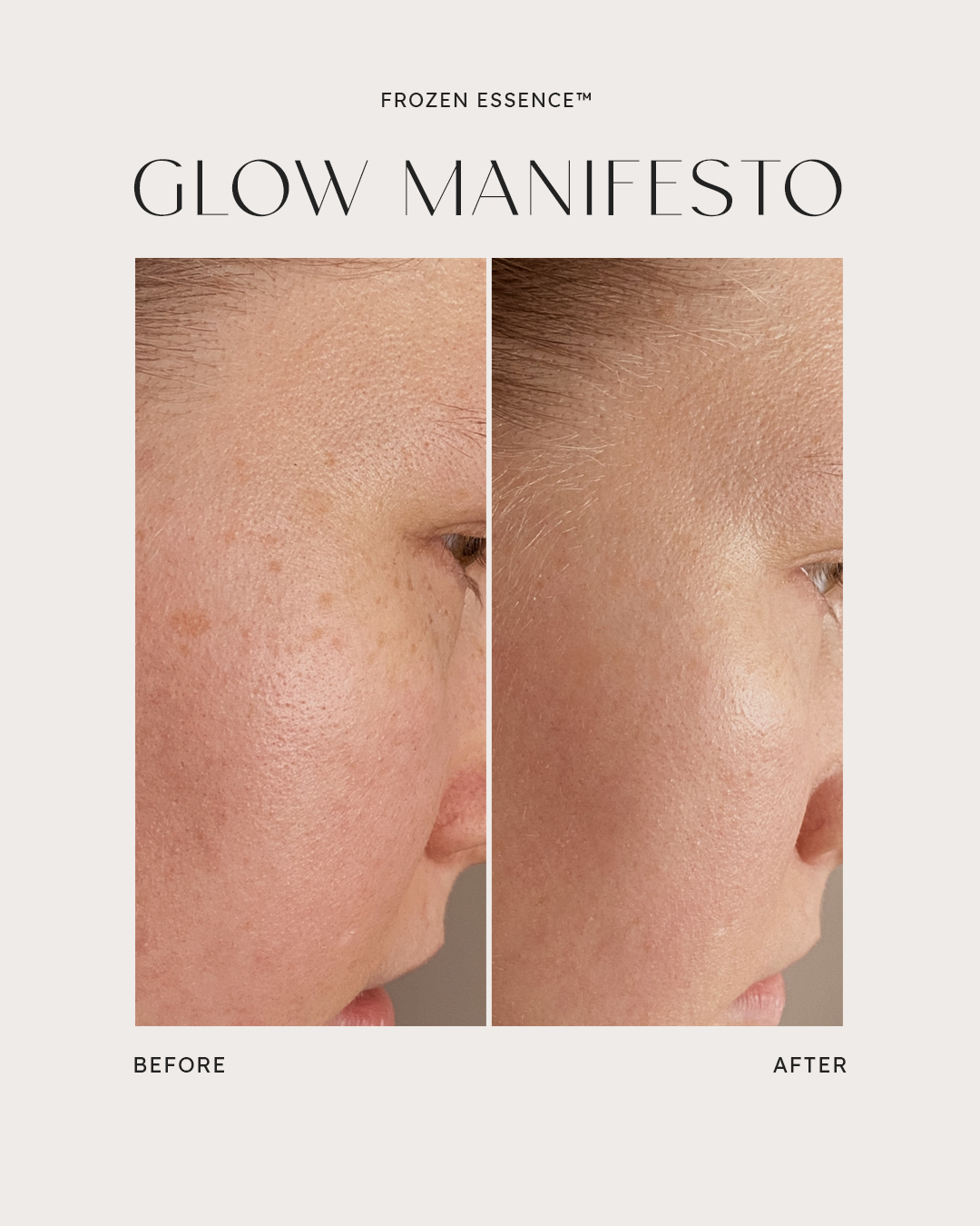Before and after — Glow Manifesto · Pigmentation