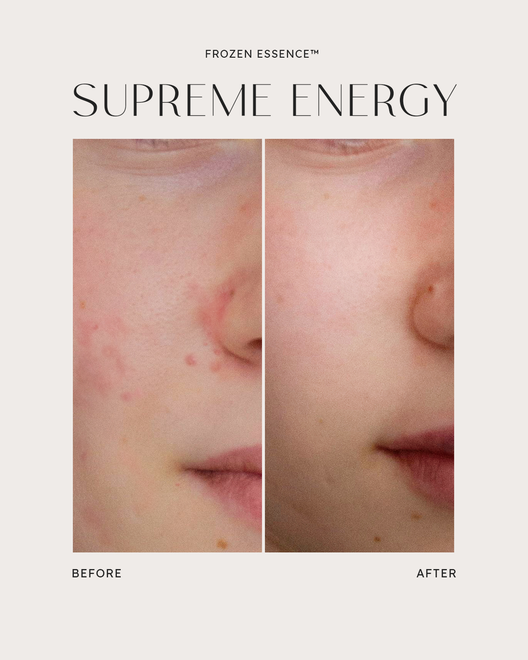 Before and after — Supreme Energy · Inflammation cleared