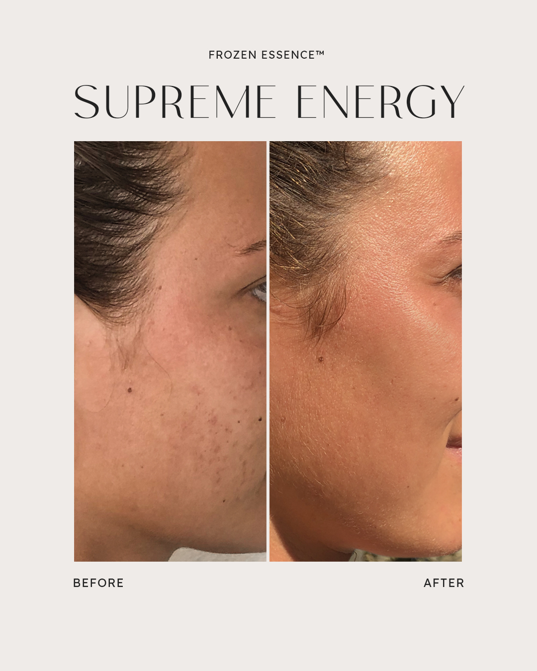Before and after — Supreme Energy · Clarity restored