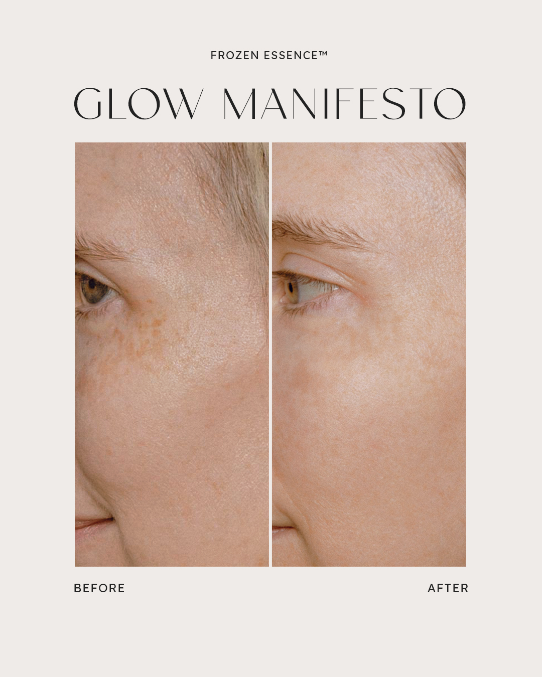 Before and after — Glow Manifesto · Sun spots brightened