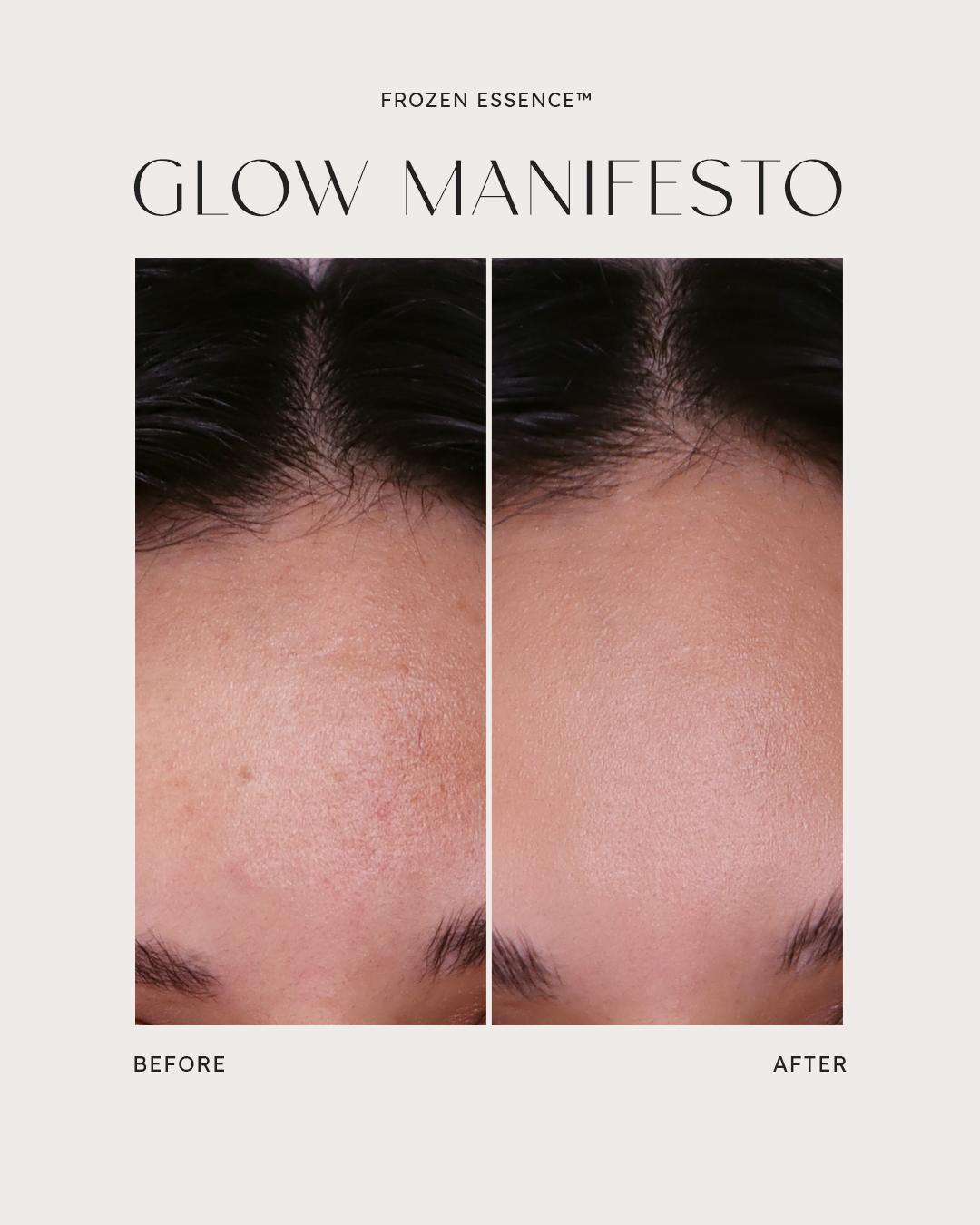 Before and after — Glow Manifesto · Texture & clarity