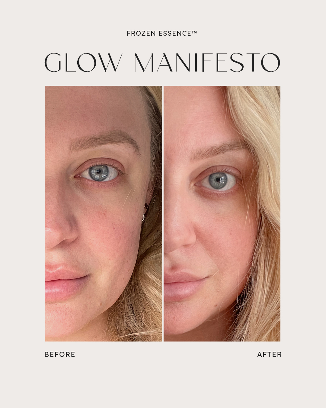 Before and after — Glow Manifesto · Redness & even tone