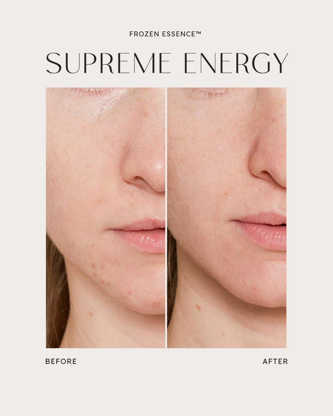 Before and after — Supreme Energy · Smoother jawline