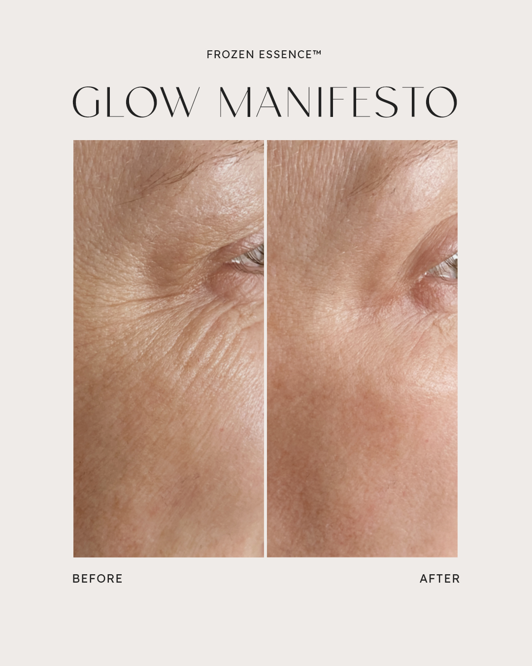Before and after — Glow Manifesto · Fine lines, outer eye