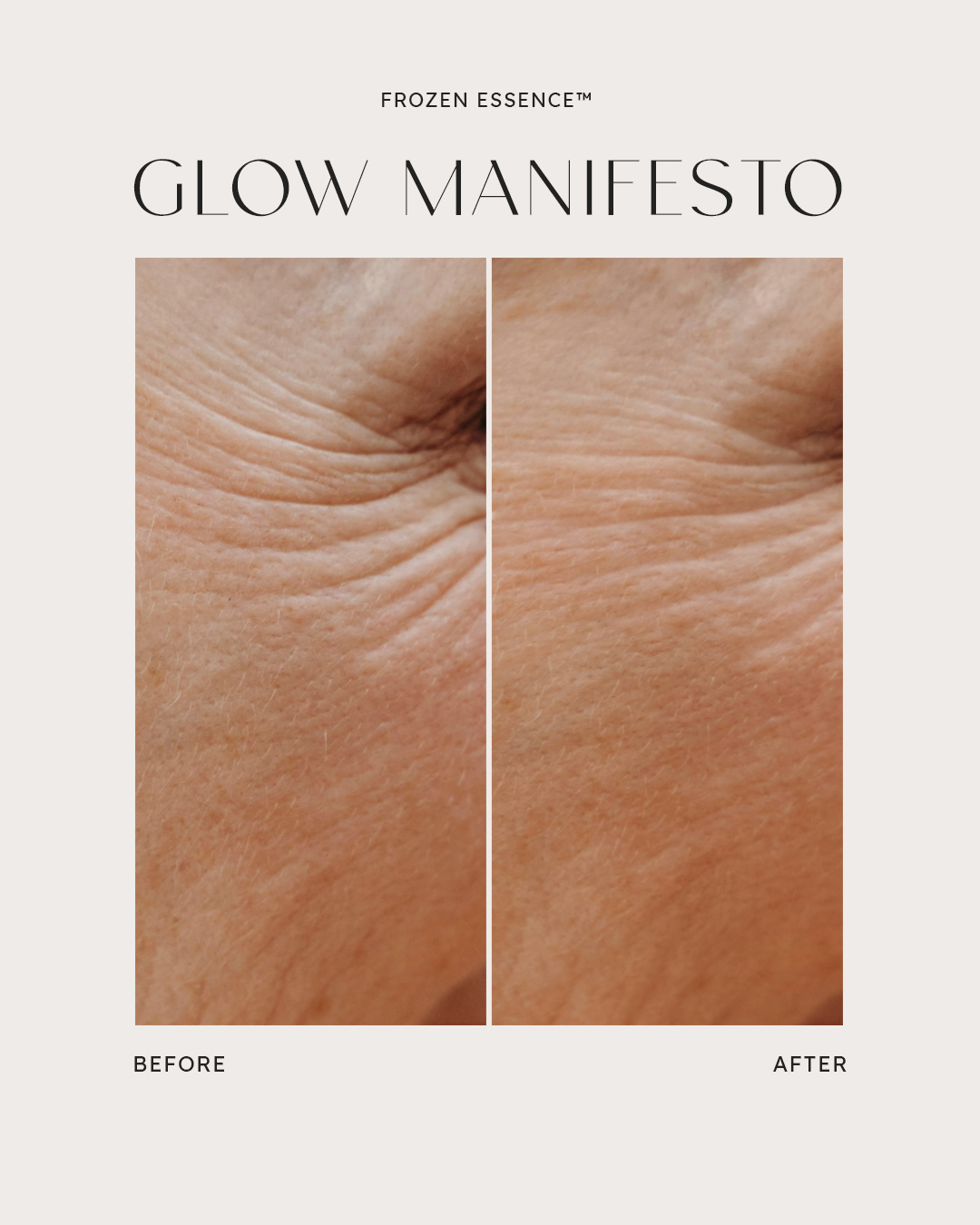 Before and after — Glow Manifesto · Crepe lines